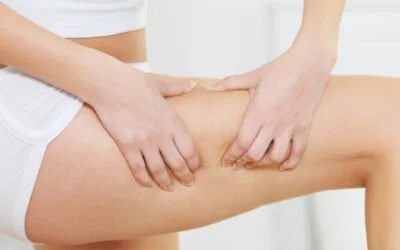 Best 10 Foods That Can Help You to Fight Cellulite