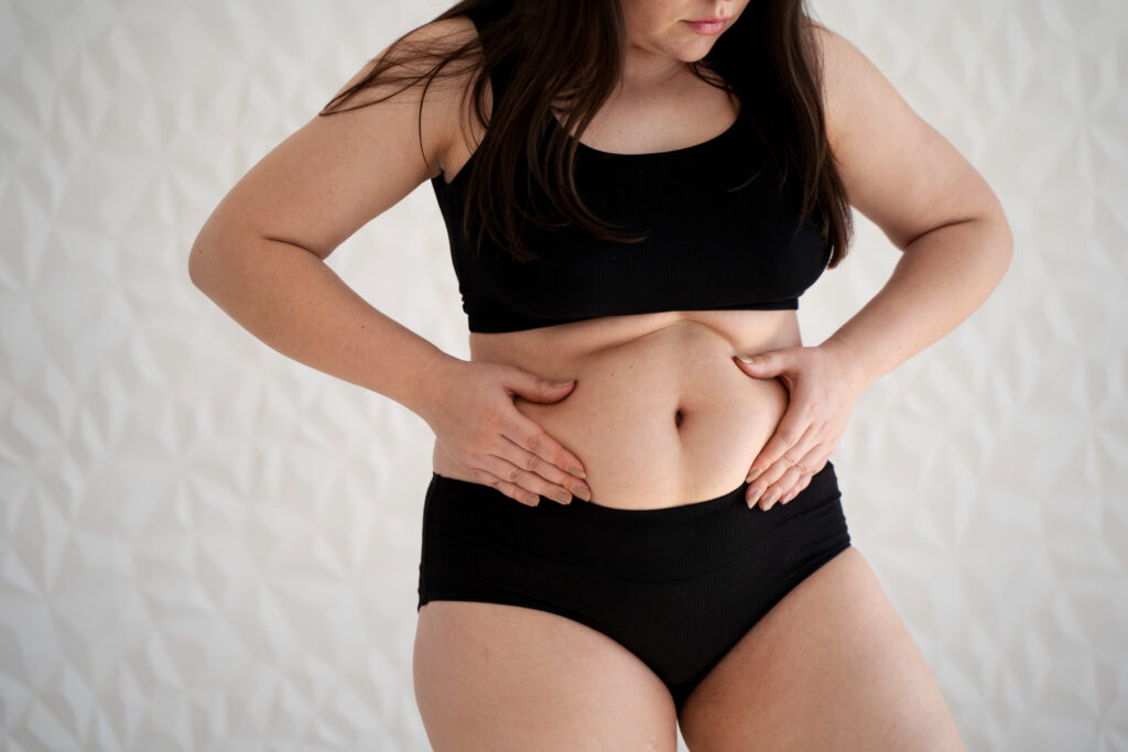 The Reason Why Many Women Lose Fat in the Abdominal Area but Not in the Hips